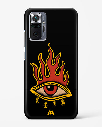 Blaze Vision Hard Case Phone Cover-(Xiaomi)