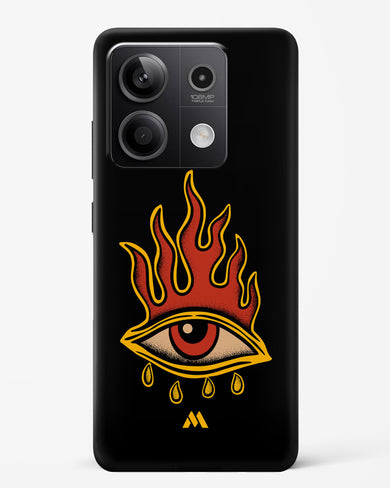 Blaze Vision Hard Case Phone Cover (Xiaomi)