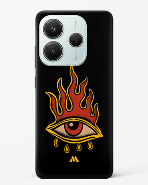Blaze Vision Hard Case Phone Cover (Xiaomi)
