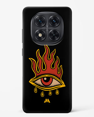 Blaze Vision Hard Case Phone Cover (Xiaomi)