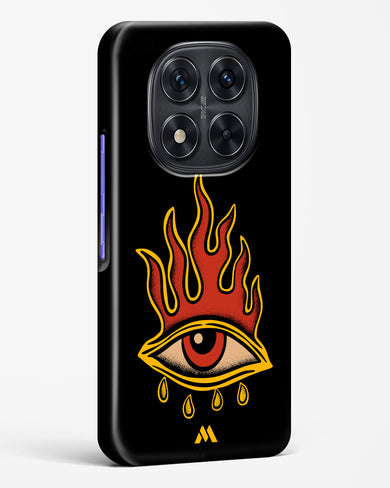 Blaze Vision Hard Case Phone Cover (Xiaomi)