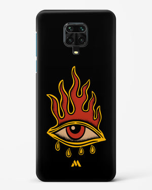 Blaze Vision Hard Case Phone Cover-(Xiaomi)