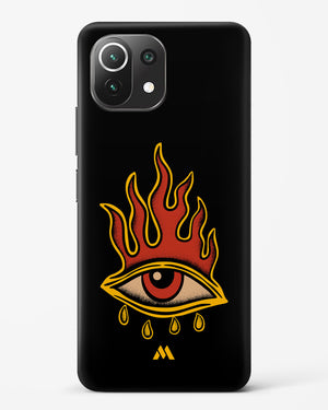 Blaze Vision Hard Case Phone Cover-(Xiaomi)