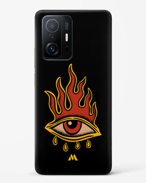 Blaze Vision Hard Case Phone Cover (Xiaomi)