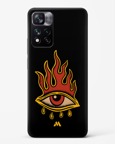 Blaze Vision Hard Case Phone Cover-(Xiaomi)