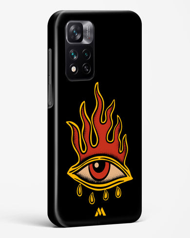 Blaze Vision Hard Case Phone Cover-(Xiaomi)