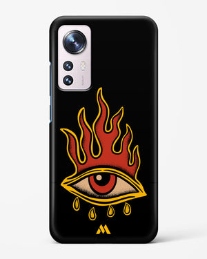 Blaze Vision Hard Case Phone Cover-(Xiaomi)