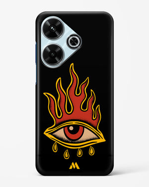 Blaze Vision Hard Case Phone Cover (Xiaomi)