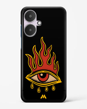 Blaze Vision Hard Case Phone Cover (Xiaomi)