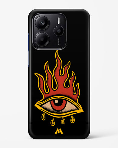 Blaze Vision Hard Case Phone Cover (Xiaomi)