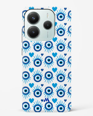 Eye Heart Embrace Hard Case Phone Cover (Xiaomi)