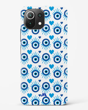 Eye Heart Embrace Hard Case Phone Cover-(Xiaomi)