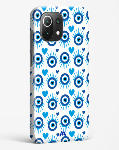 Eye Heart Embrace Hard Case Phone Cover-(Xiaomi)