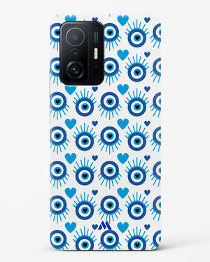 Eye Heart Embrace Hard Case Phone Cover-(Xiaomi)