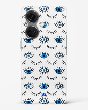 Eyes Wide Shut Hard Case Phone Cover (OnePlus)