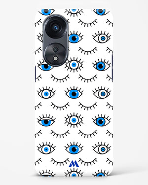 Eyes Wide Shut Hard Case Phone Cover-(Oppo)