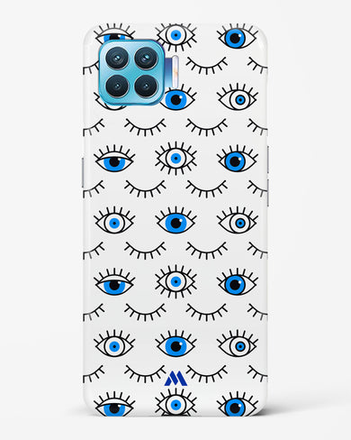 Eyes Wide Shut Hard Case Phone Cover-(Oppo)