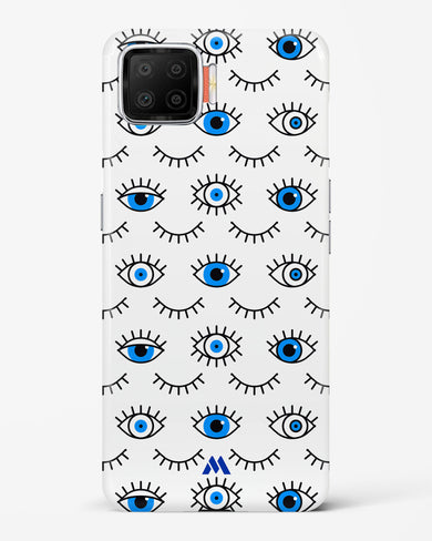 Eyes Wide Shut Hard Case Phone Cover-(Oppo)