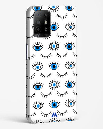 Eyes Wide Shut Hard Case Phone Cover-(Oppo)