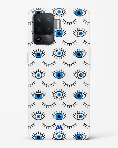 Eyes Wide Shut Hard Case Phone Cover-(Oppo)