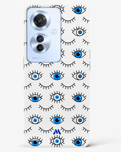 Eyes Wide Shut Hard Case Phone Cover (Oppo)