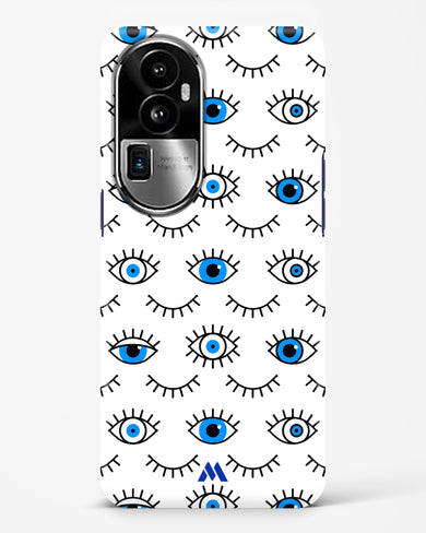 Eyes Wide Shut Hard Case Phone Cover (Oppo)