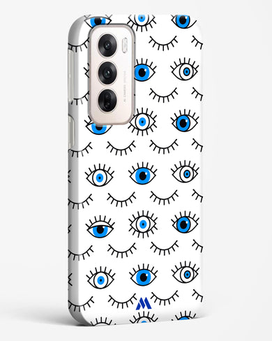 Eyes Wide Shut Hard Case Phone Cover (Oppo)