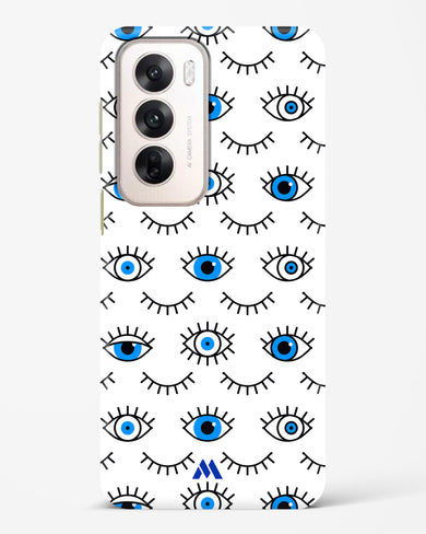 Eyes Wide Shut Hard Case Phone Cover (Oppo)