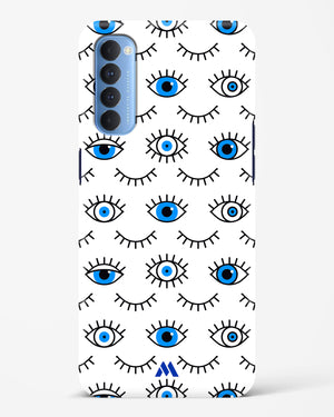 Eyes Wide Shut Hard Case Phone Cover-(Oppo)