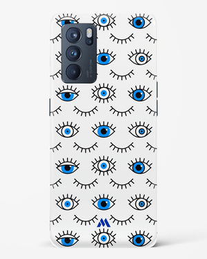 Eyes Wide Shut Hard Case Phone Cover (Oppo)