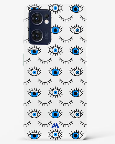 Eyes Wide Shut Hard Case Phone Cover (Oppo)