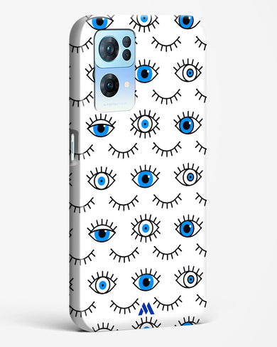 Eyes Wide Shut Hard Case Phone Cover (Oppo)