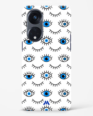 Eyes Wide Shut Hard Case Phone Cover-(Oppo)