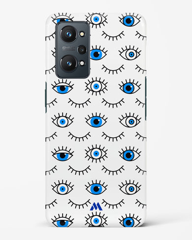 Eyes Wide Shut Hard Case Phone Cover-(Realme)