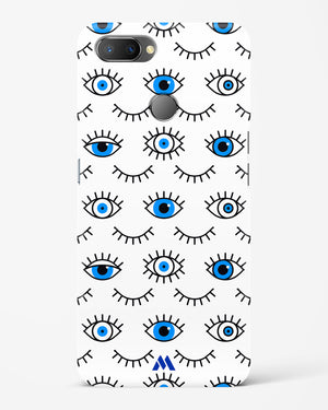 Eyes Wide Shut Hard Case Phone Cover-(Realme)