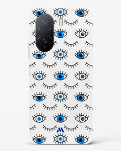Eyes Wide Shut Hard Case Phone Cover (Vivo)