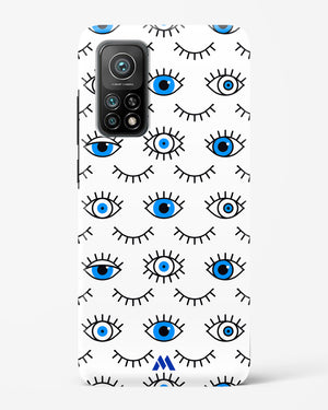 Eyes Wide Shut Hard Case Phone Cover (Xiaomi)