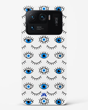 Eyes Wide Shut Hard Case Phone Cover-(Xiaomi)