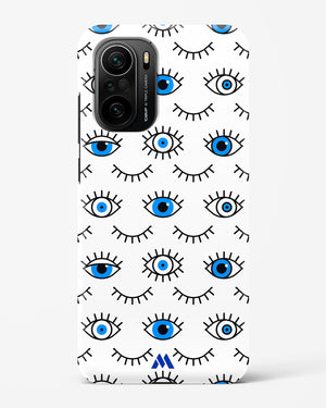 Eyes Wide Shut Hard Case Phone Cover (Xiaomi)