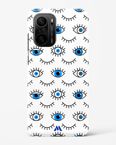 Eyes Wide Shut Hard Case Phone Cover-(Xiaomi)