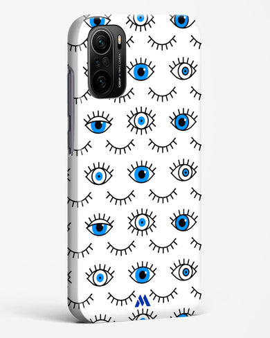 Eyes Wide Shut Hard Case Phone Cover-(Xiaomi)