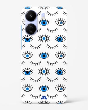 Eyes Wide Shut Hard Case Phone Cover (Xiaomi)