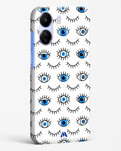 Eyes Wide Shut Hard Case Phone Cover (Xiaomi)