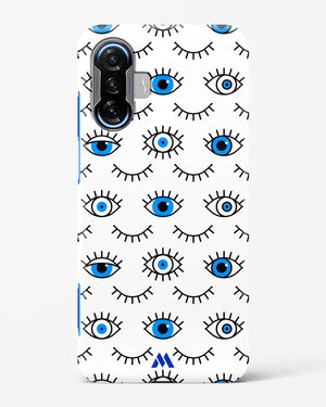 Eyes Wide Shut Hard Case Phone Cover (Xiaomi)