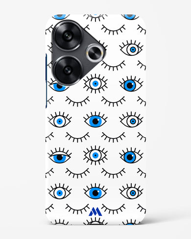 Eyes Wide Shut Hard Case Phone Cover (Xiaomi)