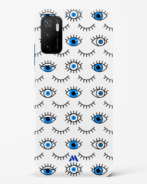 Eyes Wide Shut Hard Case Phone Cover-(Xiaomi)