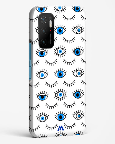 Eyes Wide Shut Hard Case Phone Cover-(Xiaomi)