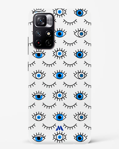 Eyes Wide Shut Hard Case Phone Cover-(Xiaomi)