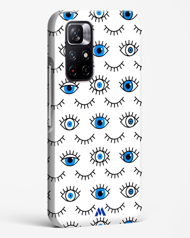 Eyes Wide Shut Hard Case Phone Cover-(Xiaomi)