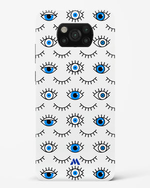 Eyes Wide Shut Hard Case Phone Cover-(Xiaomi)